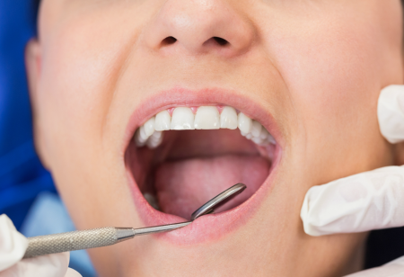 Dentist Examining Mouth 